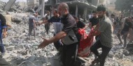 صحة غزة: ارتفاع عدد شهداء الحرب على غزة إلى 35562 و 79652 مصابا