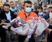 الصحة: ارتفاع عدد شهداء العدوان على غزة إلى 34262 شهيدا و 77229 مصابا