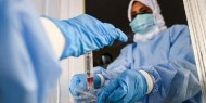 الصحة: 11 وفاة و580 إصابة جديدة بفيروس كورونا