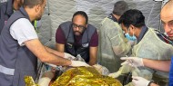 صور | وصول إصابة خطيرة للمستشفى الميداني الإماراتي جراء قصف منزل في رفح جنوب القطاع