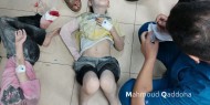 مصابون معظم أطفال جراء قصف الاحتلال منزلا غربي مخيم النصيرات