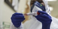 الصحة: وفاتان و127 إصابة بفيروس كورونا خلال أسبوع