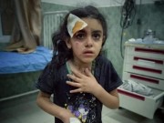 «أونروا»: أطفال غزة يعانون مستويات توتر مدمرة